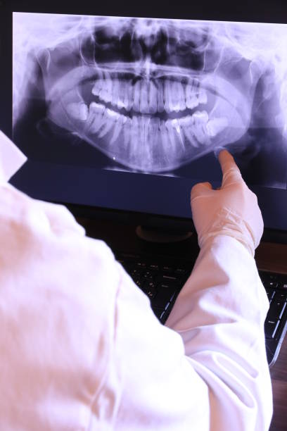 Best Emergency Wisdom Teeth Removal in Lake City, FL